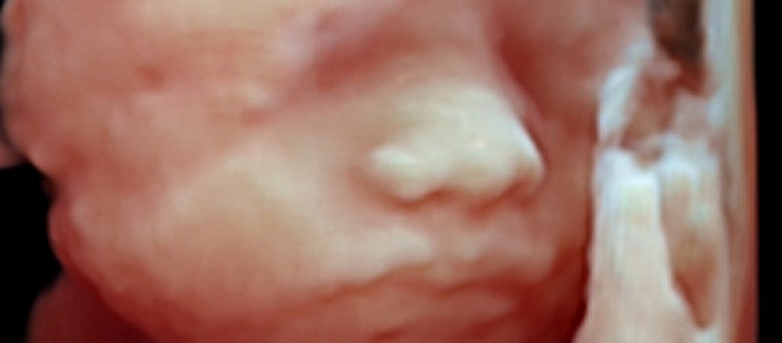 Foto19